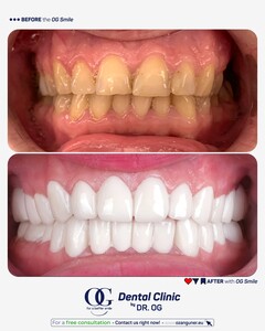 Image of Dental treatment 