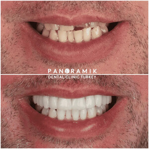 Image of Panoramik Dental Gallery 3