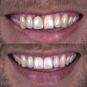 Image of Boulder Restorative Dentistry Gallery 3