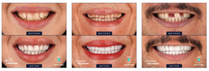 Image of Omer Istanbul Dental Center Gallery 0