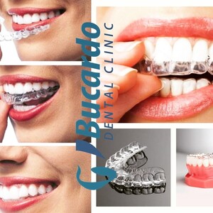 Image of Invisalign