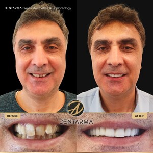 Image of DentArma Turkey Dental Clinic Gallery 1