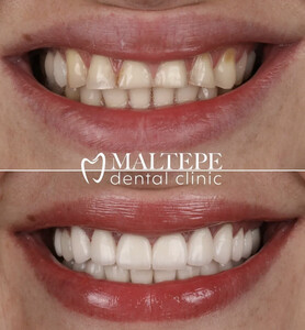 Image of Maltepe Dental Clinic Gallery 0