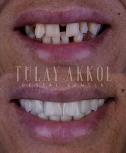 Image of Tülay Akkol Dental Center Gallery 2