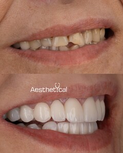 Image of Smile design - Aesthetical Clinic