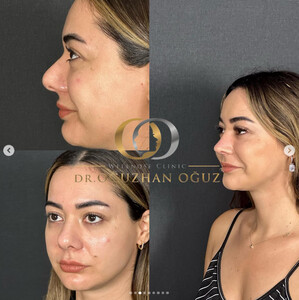 Image of Dr. Oğuzhan Oğuz Wellnose Clinic Gallery 0