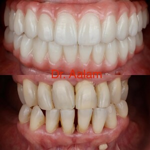 Image of Smile makeover