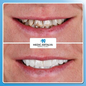 Image of Medic Antalya Dental Clinic Gallery 0