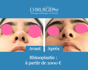 Image of ChirurgiePro - Chirurgie esthétique en Tunisie Gallery 0