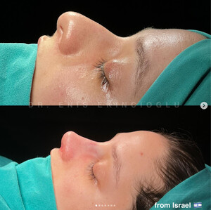 Image of Dr. Enis Ekincioğlu Istanbul Rhinoplasty Clinic Gallery 2