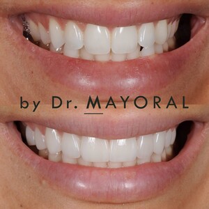 Image of Barcelona Smile Center by Dr. Mayoral Gallery 2