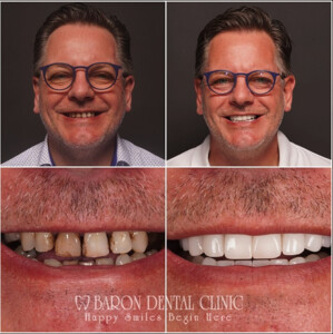 Image of Baron Dental Clinic Gallery 2