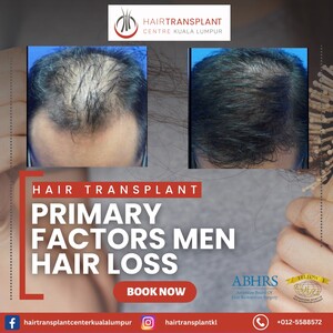 Image of Hair Transplant Kuala Lumpur Gallery 1