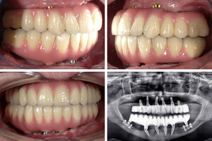 Image of Ortoimplant Dent Spa Gallery 3