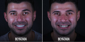 Image of BeyazAda Dental Clinic Gallery 1