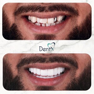 Image of Dent X Dental Polyclinic Gallery 2