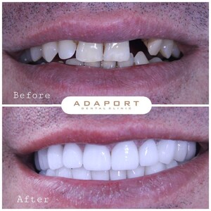 Image of Adaport Dental Clinic Gallery 3