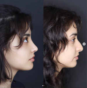 Image of Dr. Sedat Avşar -  HLC Plastic Surgery Center Gallery 1