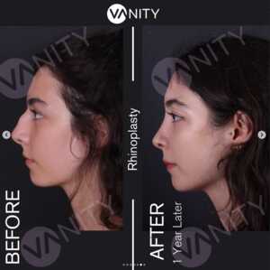 Image of Vanity Cosmetic Surgery Hospital Gallery 0