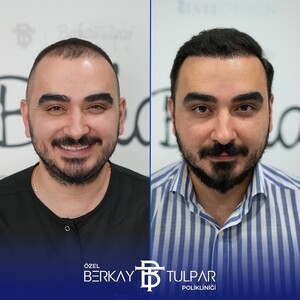 Image of Berkay Tulpar Clinic Gallery 0