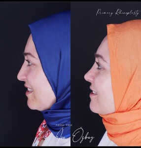 Image of MD.Assoc. Dr. İsa ÖZBAY Gallery 3