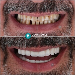 Image of DentaSmile Turkey Gallery 3