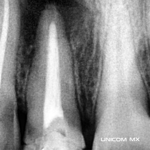 Image of Dental X-Ray