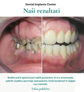 Image of Digital Smile Design