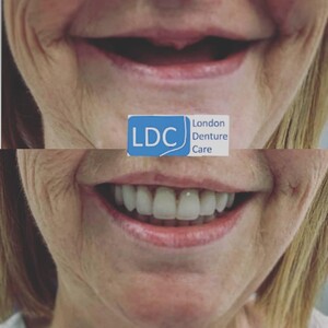 Image of London Denture Care Gallery 0