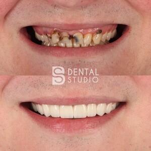 Image of BS Dental Studio Gallery 2