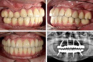 Image of Ortoimplant Dent Spa Gallery 1