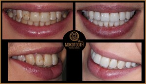 Image of Mokotooth Prestige Dental Gallery 3