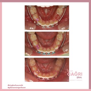 Image of Dr.Specialist Dr. Çağrı Şibal Gallery 3