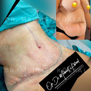 Image of Op.Dr. Mehmet Köksal Aesthetic Surgery Clinic Gallery 1