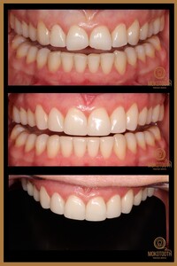 Image of Mokotooth Prestige Dental Gallery 0