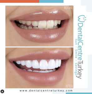 Image of Dental Centre Turkey Gallery 3