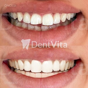 Image of DentVita Dental Clinic Gallery 0