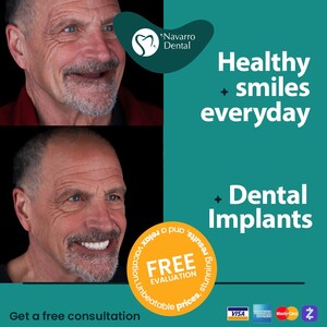 Image of Full mouth dental implants