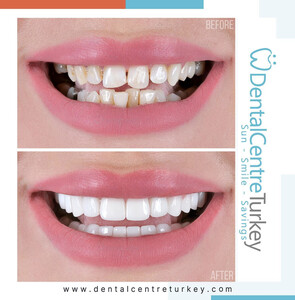 Image of Dental Centre Turkey Gallery 2