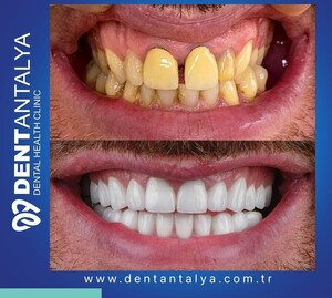 Image of DentAntalya Dental Health Clinic Gallery 3