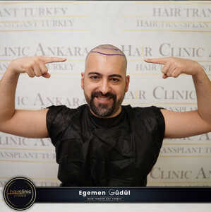 Image of Egemen Güdül Hair Clinic Ankara Gallery 2