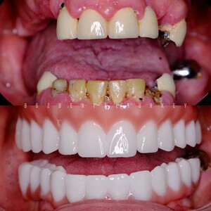 Image of BGZ Dental Turkey Gallery 0