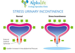 Image of Alphalife Urology And Andrology Center Gallery 2