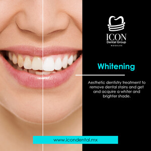 Image of Teeth whitening