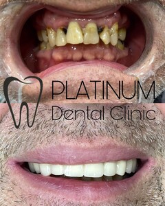 Image of Platinum Dental Clinic Gallery 3