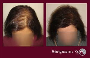 Image of Bergmann Kord Hair Clinic Gallery 2