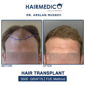 Image of HairMedico Gallery 1