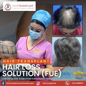 Image of Hair Transplant Kuala Lumpur Gallery 2