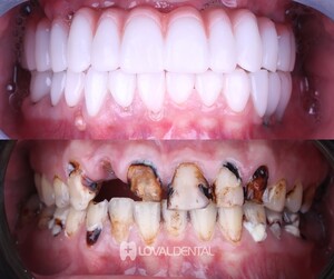 Image of Smile Makeover