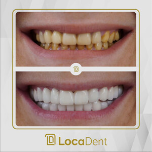 Image of LocaDent Dental Clinic Bayrakli Gallery 1